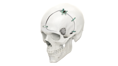 (IMAGE 1) LEFORTE NEURO SYSTEM