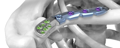 (IMAGE 3) ASTROLABE Small-Fragments