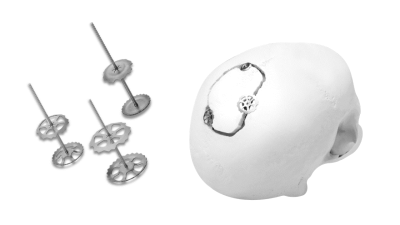 (IMAGE 4) SPEEDY FLAP